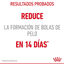 10 kg Royal Canin Intense Hairball ração para gatos, , large Indicador imagem número 6